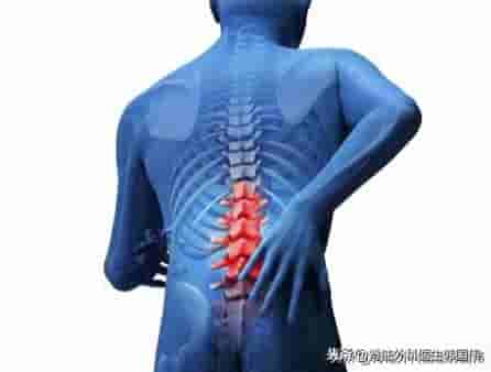 腰L5-骶S1腰椎滑脱，椎间盘突出压迫神经，走路困难该怎么办？