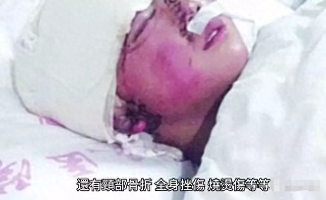 “美女主播”边娥英柬埔寨遇害，被摘器官了？