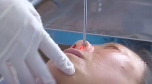 女子狂流鼻血,医生发现她鼻子里有蠕动的东西