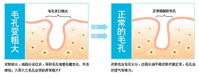 美女脸上“爬出虫子”,医生检查说出的话令人反胃,父母当场崩溃