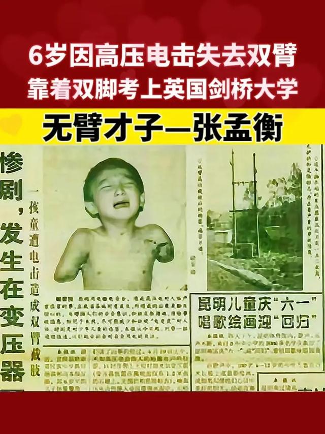 6岁失去双臂,26岁考上剑桥大学硕士,娶高学历美女为妻