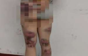 美女被用手怼(2019年，江苏一饭店女老板抄铁棍暴打闺女被刑拘：她30岁还没嫁人)