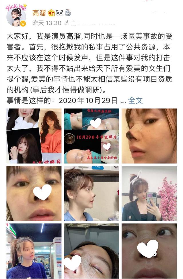 33岁网红小冉抽脂感染去世,明明可以凭才华出众,却偏偏要拼脸