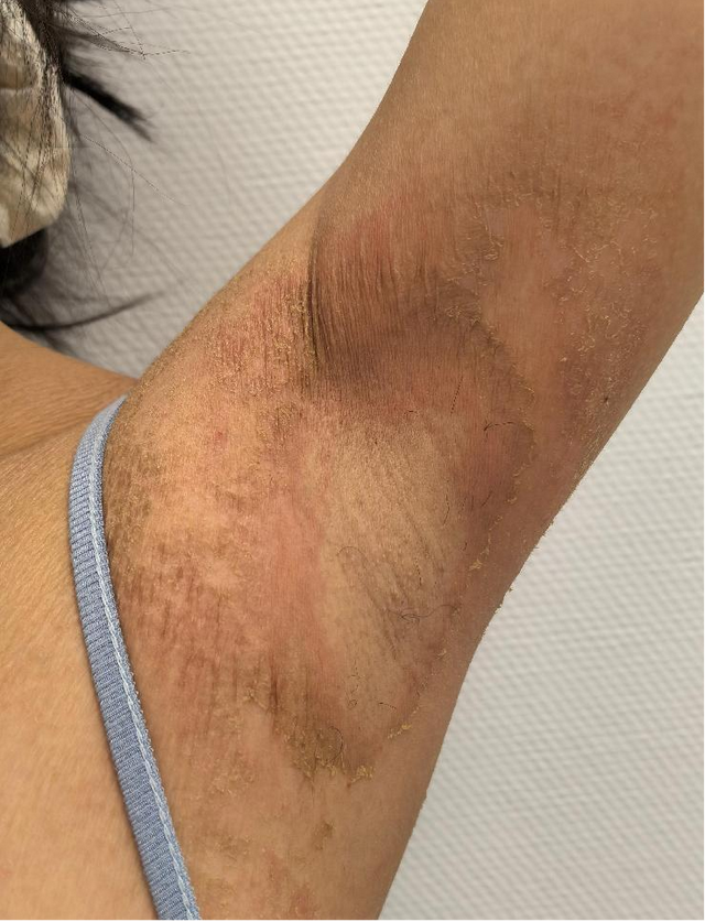 年轻女主播全身脱皮、奇痒不止!只因24小时都在…紧急提醒!