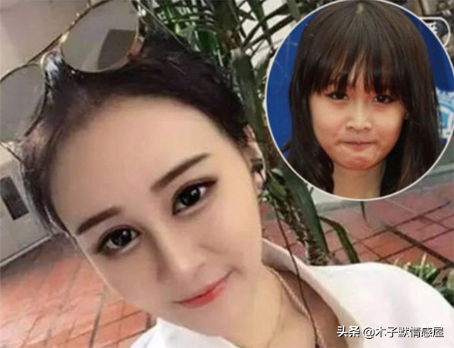 33岁网红小冉抽脂感染去世,明明可以凭才华出众,却偏偏要拼脸