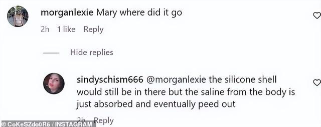 加拿大女网红沉迷整形,结果胸给隆“炸”了,剩单侧巨乳