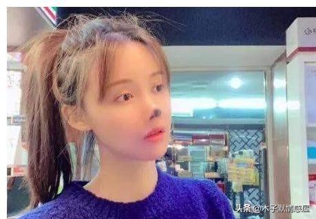 33岁网红小冉抽脂感染去世,明明可以凭才华出众,却偏偏要拼脸