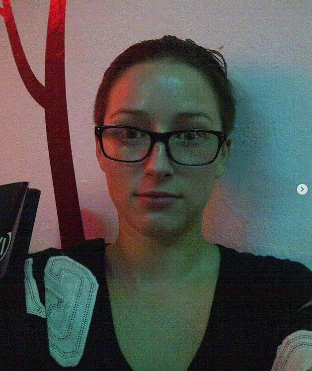加拿大女网红沉迷整形,结果胸给隆“炸”了,剩单侧巨乳