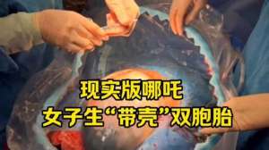 女主播静宝宝视频(现实版哪吒女子生带壳双胞胎)