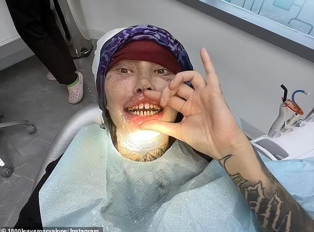 加拿大女网红沉迷整形,结果胸给隆“炸”了,剩单侧巨乳