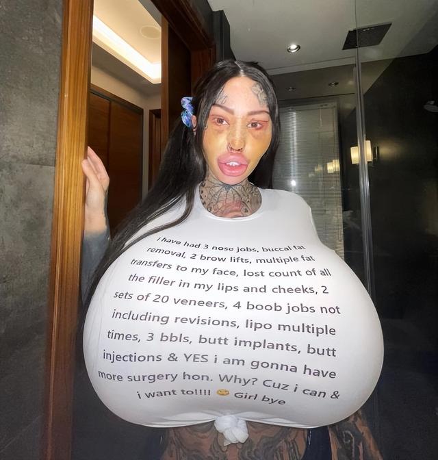 加拿大女网红沉迷整形,结果胸给隆“炸”了,剩单侧巨乳