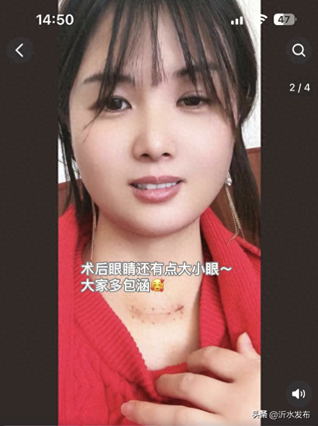又一“顶流”女主播自曝患癌!这种癌女性比男性更高发,一定要小心